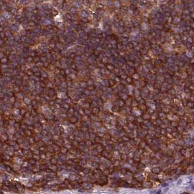 Immunohistochemistry-Paraffin: ARHGAP25 Antibody [NBP2-57228]