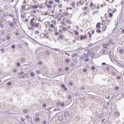 Immunohistochemistry-Paraffin: ARHGAP25 Antibody [NBP2-57228]