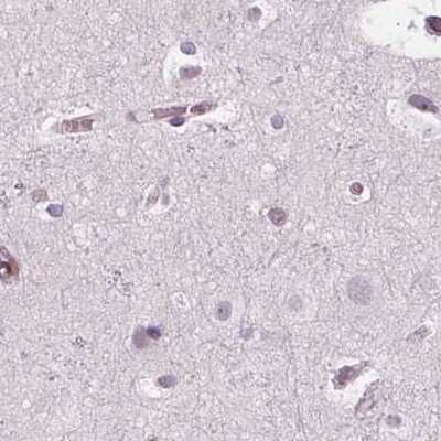 Immunohistochemistry-Paraffin: ARHGAP25 Antibody [NBP2-57228]