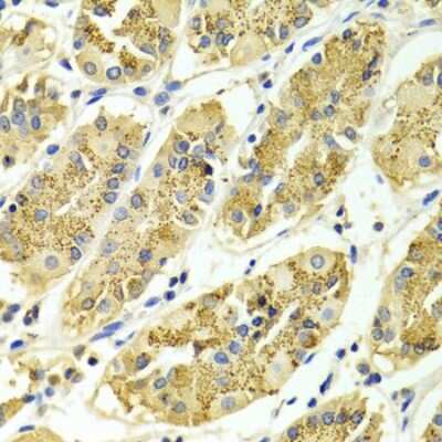Immunohistochemistry-Paraffin: ARHGAP25 Antibody - BSA Free [NBP2-92851]