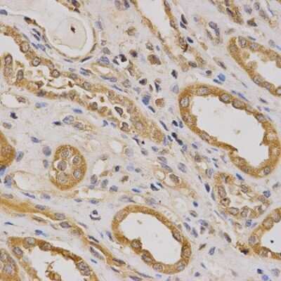 Immunohistochemistry-Paraffin: ARHGAP25 Antibody - BSA Free [NBP2-92851]