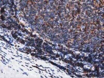 Immunohistochemistry: ARHGAP25 Antibody (OTI2D5) - Azide and BSA Free [NBP2-71508]