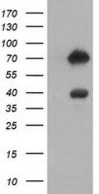 Western Blot: ARHGAP25 Antibody (OTI2D5)Azide and BSA Free [NBP2-71508]