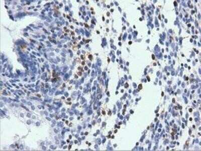 Immunohistochemistry-Paraffin: ARHGAP25 Antibody (OTI2D5) [NBP2-03024]