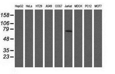 Western Blot: ARHGAP25 Antibody (OTI2D5) [NBP2-03024]