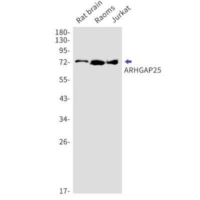 Western Blot: ARHGAP25 Antibody (S07-6G6) [NBP3-15000]