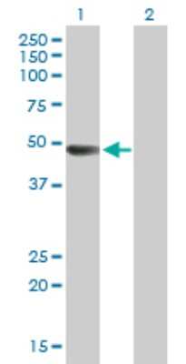 Western Blot: ARHGAP25 Antibody [H00009938-B01P]