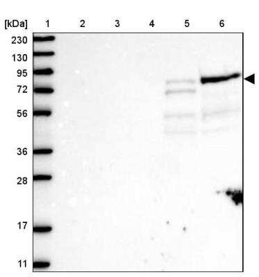 Western Blot: ARHGAP25 Antibody [NBP1-83053]