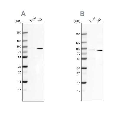 Western Blot: ARHGAP25 Antibody [NBP1-83053]