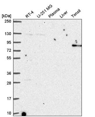 Western Blot: ARHGAP25 Antibody [NBP2-57228]