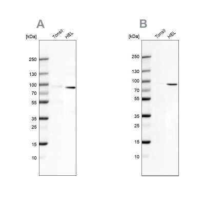 Western Blot: ARHGAP25 Antibody [NBP2-57228]