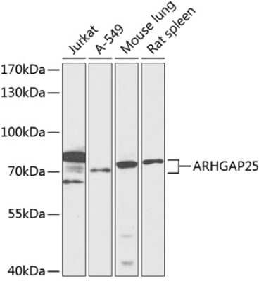 Western Blot: ARHGAP25 AntibodyBSA Free [NBP2-92118]