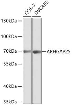 Western Blot: ARHGAP25 AntibodyBSA Free [NBP2-92851]