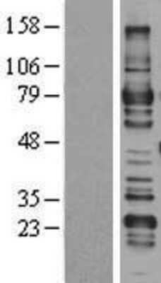 Western Blot: ARHGAP25 Overexpression Lysate [NBL1-07669]