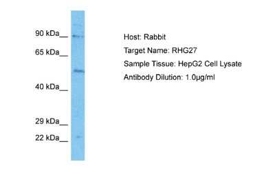 Western Blot: ARHGAP27 Antibody [NBP2-84452]