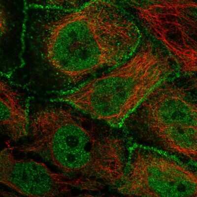 Immunocytochemistry/ Immunofluorescence: ARHGAP28 Antibody [NBP1-84640]