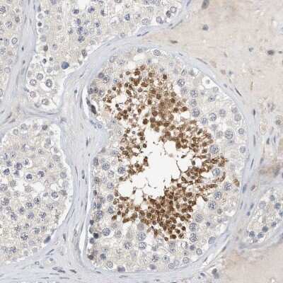 Immunohistochemistry-Paraffin: ARHGAP28 Antibody [NBP1-84640]