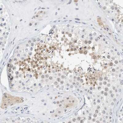 Immunohistochemistry-Paraffin: ARHGAP28 Antibody [NBP1-84641]