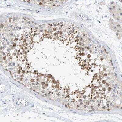 Immunohistochemistry-Paraffin: ARHGAP28 Antibody [NBP1-84642]