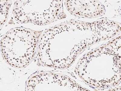 Immunohistochemistry-Paraffin: ARHGAP28 Antibody [NBP2-99176]