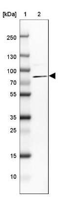 Western Blot: ARHGAP28 Antibody [NBP1-84642]