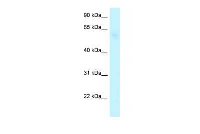 Western Blot: ARHGAP28 Antibody [NBP2-87026]