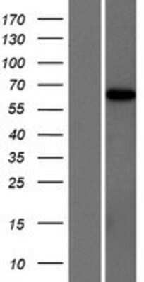 Western Blot: ARHGAP28 Overexpression Lysate [NBP2-08759]