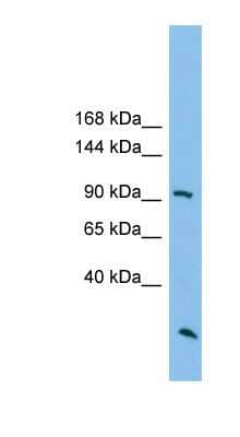 Western Blot: ARHGAP30 Antibody [NBP1-79547]