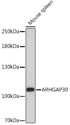 Western Blot: ARHGAP30 AntibodyAzide and BSA Free [NBP3-15556]