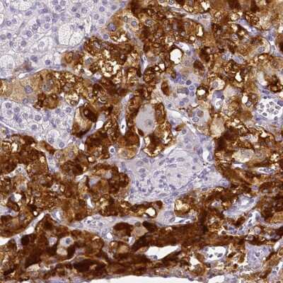 Immunohistochemistry-Paraffin: ARHGAP36 Antibody [NBP1-93894]
