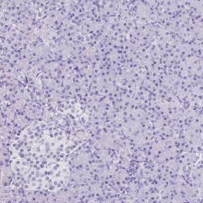 Immunohistochemistry-Paraffin: ARHGAP36 Antibody [NBP1-93894]