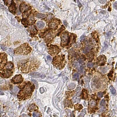 Immunohistochemistry-Paraffin: ARHGAP36 Antibody [NBP1-93894]