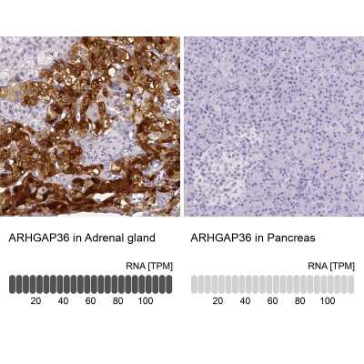 Immunohistochemistry-Paraffin: ARHGAP36 Antibody [NBP1-93894]