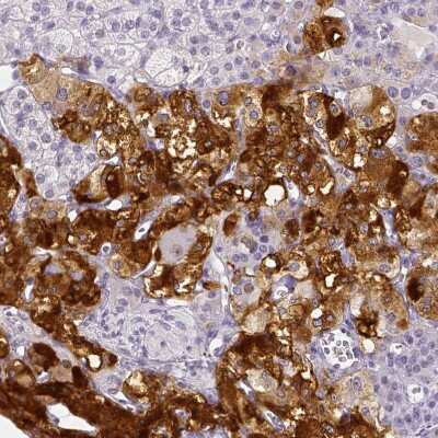 Immunohistochemistry-Paraffin: ARHGAP36 Antibody [NBP1-93894]