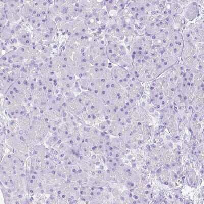 Immunohistochemistry-Paraffin: ARHGAP36 Antibody [NBP1-93894]