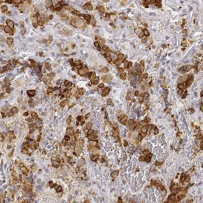 Immunohistochemistry-Paraffin: ARHGAP36 Antibody [NBP1-93894]