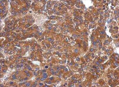 Immunohistochemistry-Paraffin: ARHGAP36 Antibody [NBP2-15453]