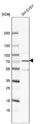 Western Blot: ARHGAP36 Antibody [NBP1-93894]