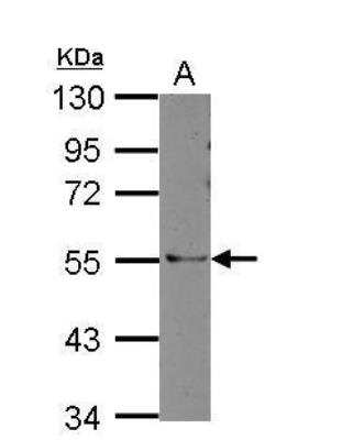 Western Blot: ARHGAP36 Antibody [NBP2-15453]