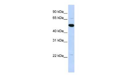 Western Blot: ARHGAP36 Antibody [NBP2-87027]