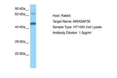 Western Blot: ARHGAP36 Antibody [NBP2-87027]
