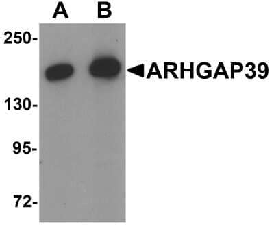 Western Blot: ARHGAP39 AntibodyBSA Free [NBP2-81940]