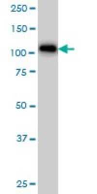 Western Blot: ARHGAP4 Antibody (3F7) [H00000393-M01]