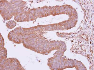 Immunohistochemistry-Paraffin: ARHGAP4 Antibody [NBP1-31976]