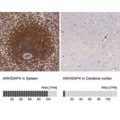 Immunohistochemistry-Paraffin: ARHGAP4 Antibody [NBP1-88527]