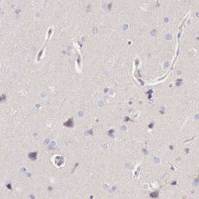 Immunohistochemistry-Paraffin: ARHGAP4 Antibody [NBP1-88528]