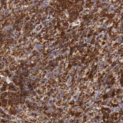 Immunohistochemistry-Paraffin: ARHGAP4 Antibody [NBP1-88528]
