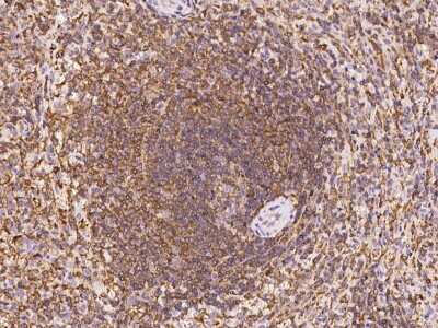 Immunohistochemistry-Paraffin: ARHGAP4 Antibody [NBP2-97915]