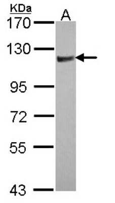 Western Blot: ARHGAP4 Antibody [NBP1-31976]