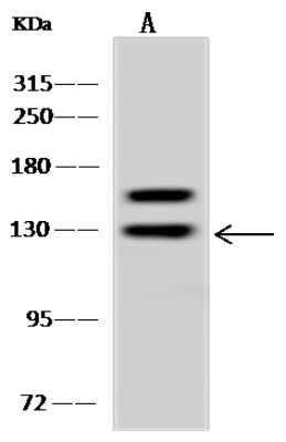 Western Blot: ARHGAP4 Antibody [NBP2-97914]